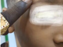 Kasus Penganiayaan Anak di Medan Mandek, Kinerja Polrestabes Medan Dipertanyakan