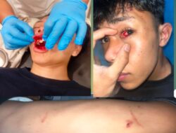 Sidikalang Berdarah: Pengeroyokan Brutal di Simpang Pujes, Polisi Dinilai “Tebang Pilih”