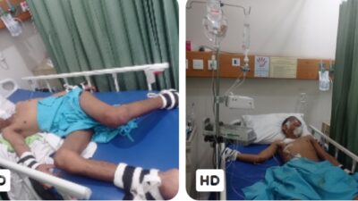 Berjuang Lawan Kanker Sejak Kecil, Pemuda Asal Kuansing Terbaring Lemah di Jakarta Butuh Uluran Tangan