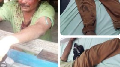 SENGKETA LAHAN BERMETERAN HINGGA DARAH! Robert Sihotang Dikeroyok 3 Orang Hingga Luka Parah  Polres Dairi Diminta Usut Tuntas TANPA KOMPROMI